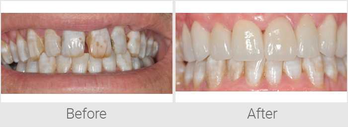 cosmetic-dentistry-4