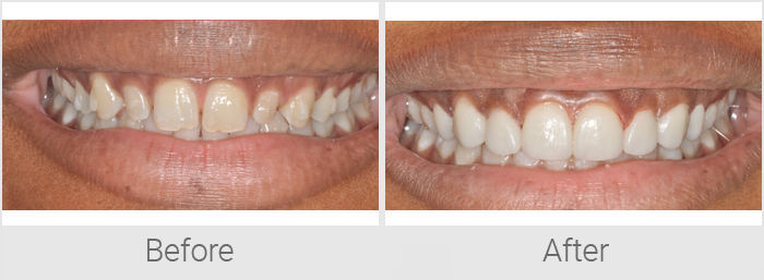 cosmetic-dentistry-6