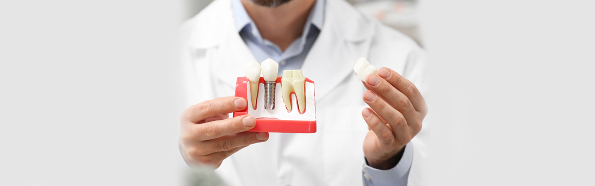A Minimally Invasive Option for Tooth Replacement